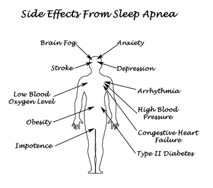 drawing showing the many health effects which is why sleep apnea can be so bad