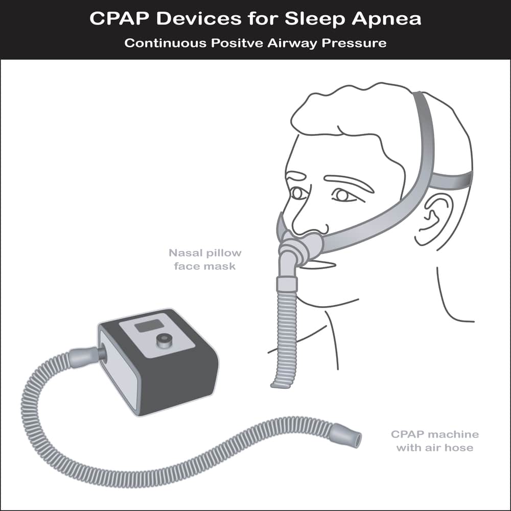 illustration of CPAP setup showing parts to check if CPAP is stressing you out