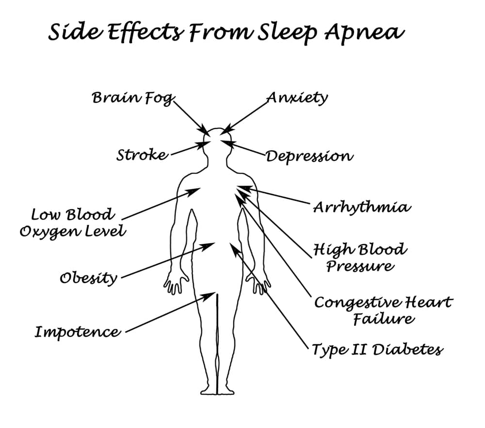 Drawing showing the side effects of sleep apnea