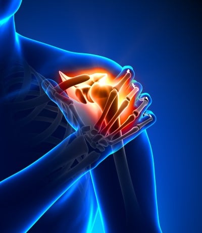 If shoulder pain is keeping you from sleeping on your side , it could be any number of things drawing of body showing what’s going on if shoulder pain is keeping you from sleeping on your side