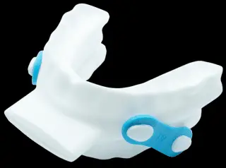 This new oral appliance is smarter than the old ones Photo of O2Vent optima mouthpiece, one of the latest sleep apnea technologies