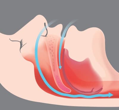 illustration showing passage of air through the upper airway