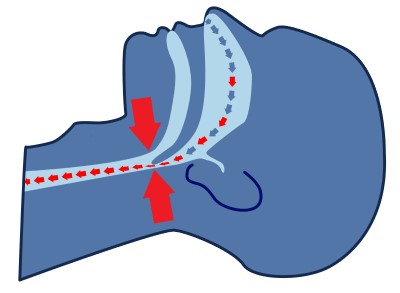 illustration showing a more narrow throat 