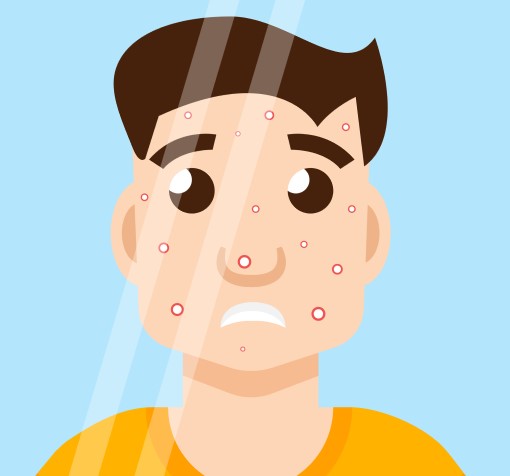It’s not as crazy as you think that CPAP causes acne cartoon drawing of man with acne after starting cpap
